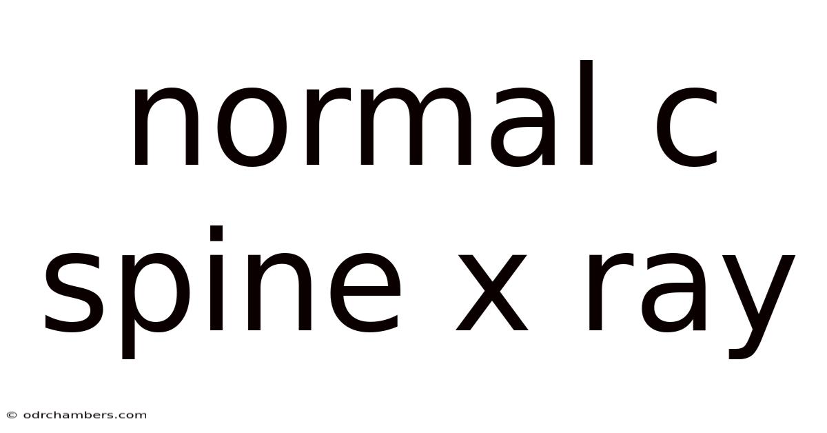Normal C Spine X Ray