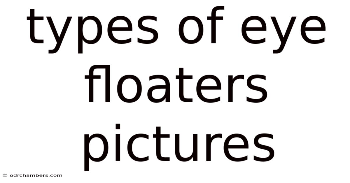Types Of Eye Floaters Pictures